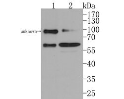 Invitrogen WASP Polyclonal Antibody 100 μL; Unconjugated:Antibodies,