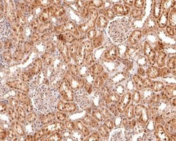 Invitrogen Myogenin Polyclonal Antibody 100 &mu;L; Unconjugated:Antibodies,