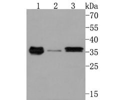 Invitrogen GNB4 Polyclonal Antibody 100 μL; Unconjugated:Antibodies,