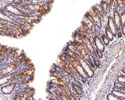 Invitrogen CIS Polyclonal Antibody 100 μL; Unconjugated:Antibodies,