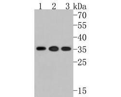 Invitrogen CIS Polyclonal Antibody 100 μL; Unconjugated:Antibodies,
