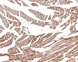 Invitrogen CNTFR Polyclonal Antibody 100 &mu;L; Unconjugated:Antibodies,