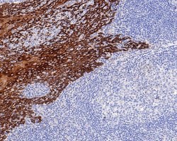 Invitrogen Cytokeratin 5/6 Polyclonal Antibody 100 &mu;L; Unconjugated:Antibodies,