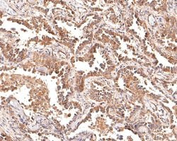 Invitrogen Cytokeratin 5/6 Polyclonal Antibody 100 &mu;L; Unconjugated:Antibodies,