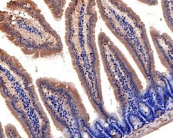 Invitrogen CLIC5 Polyclonal Antibody 100 &mu;L; Unconjugated:Antibodies,