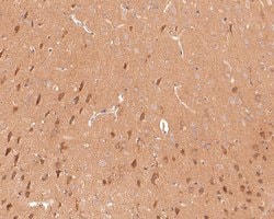 Invitrogen GNB5 Polyclonal Antibody 100 μL; Unconjugated:Antibodies,