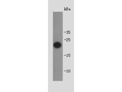 Invitrogen Shiga toxin 1B Polyclonal Antibody 100 &mu;L; Unconjugated:Antibodies,