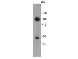 Invitrogen VEGFC Polyclonal Antibody 100 μL; Unconjugated:Antibodies,