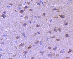 Invitrogen Tau Polyclonal Antibody 100 &mu;L; Unconjugated:Antibodies,