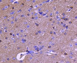 Invitrogen Tau Polyclonal Antibody 100 &mu;L; Unconjugated:Antibodies,