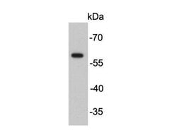 Invitrogen FokI Polyclonal Antibody 100 &mu;L | Buy Online | Invitrogen&trade; | Fisher Scientific