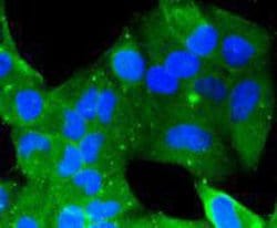 Invitrogen GDF11 Polyclonal Antibody 100 &mu;L; Unconjugated:Antibodies,