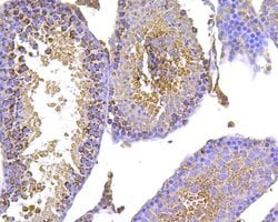 Invitrogen HSPA9 Polyclonal Antibody 100 &mu;L; Unconjugated:Antibodies,