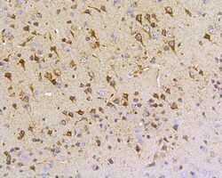 Invitrogen HSPA9 Polyclonal Antibody 100 &mu;L; Unconjugated:Antibodies,