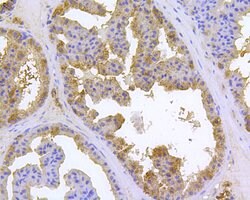 Invitrogen HSPA9 Polyclonal Antibody 100 &mu;L; Unconjugated:Antibodies,
