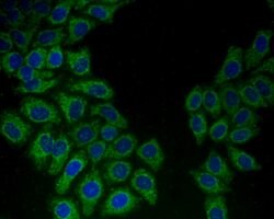 Invitrogen HSPA9 Polyclonal Antibody 100 &mu;L; Unconjugated:Antibodies,