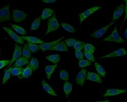 Invitrogen HSPA9 Polyclonal Antibody 100 &mu;L; Unconjugated:Antibodies,