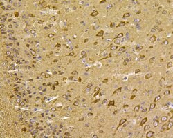 Invitrogen HSPA9 Polyclonal Antibody 100 &mu;L; Unconjugated:Antibodies,