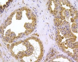 Invitrogen HSPA9 Polyclonal Antibody 100 &mu;L; Unconjugated:Antibodies,