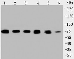 Invitrogen HSPA9 Polyclonal Antibody 100 &mu;L; Unconjugated:Antibodies,