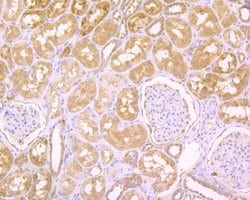 Invitrogen RNASE3 Polyclonal Antibody 100 &mu;L; Unconjugated:Antibodies,