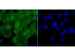 Invitrogen WDR5 Polyclonal Antibody 100 &mu;L; Unconjugated:Antibodies,