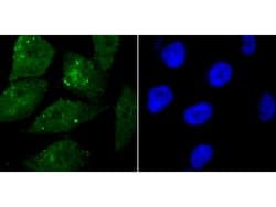 Invitrogen WDR5 Polyclonal Antibody 100 &mu;L; Unconjugated:Antibodies,