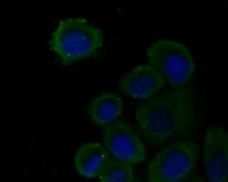 Invitrogen PLCG2 Polyclonal Antibody 100 &mu;L; Unconjugated:Antibodies,