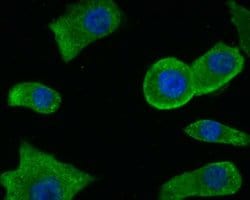 Invitrogen PKM2 Polyclonal Antibody 100 &mu;L; Unconjugated:Antibodies,