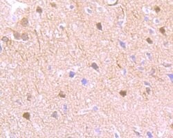 Invitrogen PKM2 Polyclonal Antibody 100 &mu;L; Unconjugated:Antibodies,