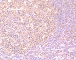 Invitrogen PKM2 Polyclonal Antibody 100 &mu;L; Unconjugated:Antibodies,