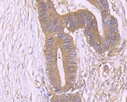 Invitrogen PKM2 Polyclonal Antibody 100 &mu;L; Unconjugated:Antibodies,