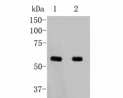 Invitrogen PKM2 Polyclonal Antibody 100 &mu;L; Unconjugated:Antibodies,
