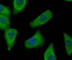 Invitrogen FASN Polyclonal Antibody 100 μL; Unconjugated:Antibodies,