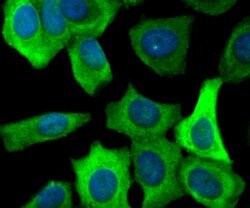 Invitrogen FASN Polyclonal Antibody 100 μL; Unconjugated:Antibodies,