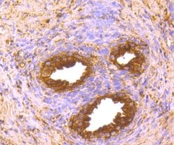 Invitrogen FASN Polyclonal Antibody 100 μL; Unconjugated:Antibodies,