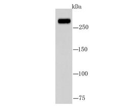 Invitrogen FASN Polyclonal Antibody 100 μL; Unconjugated:Antibodies,
