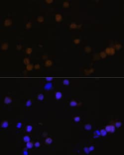 Invitrogen Rb Polyclonal Antibody 100 &mu;L; Unconjugated:Antibodies, Polyclonal