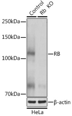 Invitrogen Rb Polyclonal Antibody 100 &mu;L; Unconjugated:Antibodies, Polyclonal