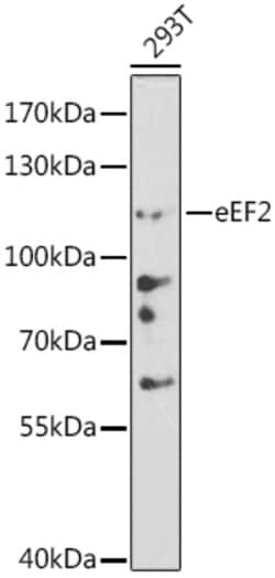 Invitrogen EEF2 Polyclonal Antibody 100 μL; Unconjugated:Antibodies,