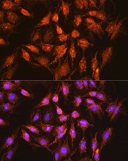 Invitrogen BCL-XL Polyclonal Antibody 100 &mu;L; Unconjugated:Antibodies,