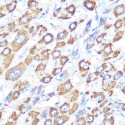 Invitrogen BCL-XL Polyclonal Antibody 100 &mu;L; Unconjugated:Antibodies,