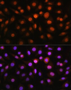 Invitrogen CHOP Polyclonal Antibody 100 &mu;L; Unconjugated:Antibodies,