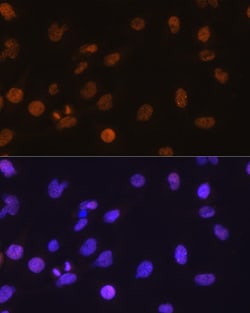 Invitrogen CHOP Polyclonal Antibody 100 &mu;L; Unconjugated:Antibodies,