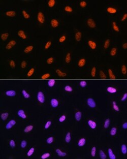 Invitrogen CHOP Polyclonal Antibody 100 &mu;L; Unconjugated:Antibodies,