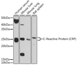 Invitrogen CRP Polyclonal Antibody 100 &mu;L; Unconjugated:Antibodies,
