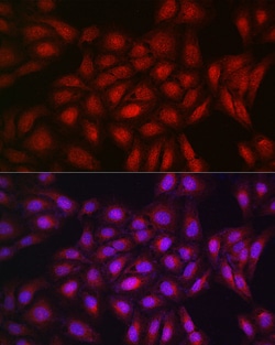 Invitrogen PPAR gamma Polyclonal Antibody 100 μL; Unconjugated:Antibodies,
