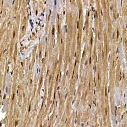 Invitrogen PPAR gamma Polyclonal Antibody 100 μL; Unconjugated:Antibodies,