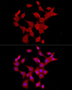 Invitrogen IL-6 Polyclonal Antibody 100 &mu;L; Unconjugated:Antibodies,