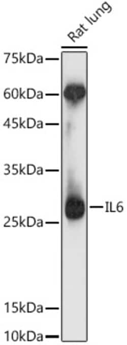 Invitrogen IL-6 Polyclonal Antibody 100 &mu;L; Unconjugated:Antibodies,